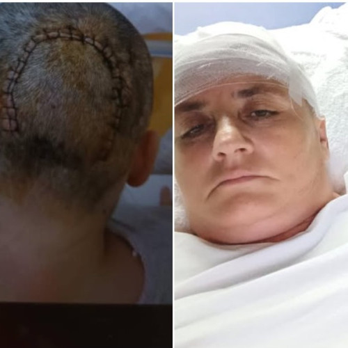 O femeie din Botoșani are nevoie urgentă de ajutor pentru o operație costisitoare